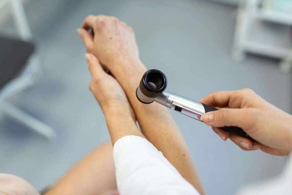 Melanoma the world's second cancer: alarming rise in cases in the last decade 1gentlewoman - Causes of melanoma